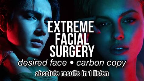ABSOLUTE RESULT IN 1 LISTEN: STRONGEST DESIRED .